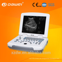 Beste Laptop-Ultraschall-Maschine &amp; digitales Ultraschall-Diagnosesystem DW-580 für großen Verkauf